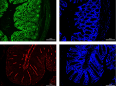 Inhibition of IRAK 1/4 alleviates colitis by inhibiting TLR4/ NF-κB pathway and protecting the intestinal barrier