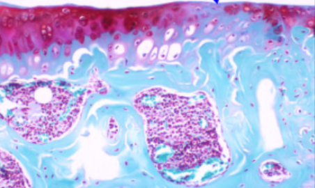 Autophagy attenuates osteoarthritis in mice by inhibiting chondrocyte pyroptosis and improving subchondral bone
