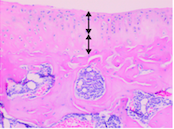 Autophagy attenuates osteoarthritis in mice by inhibiting chondrocyte pyroptosis and improving subchondral bone