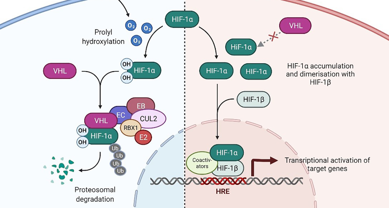 VHL tumor suppressor as a novel potential candidate biomarker in papillary thyroid carcinoma