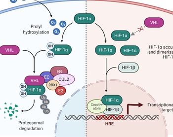 VHL tumor suppressor as a novel potential candidate biomarker in papillary thyroid carcinoma