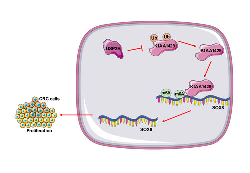 Promotive role of USP29-mediated deubiquitination in malignant proliferation of colorectal cancer cells via the KIAA1429/SOX8 axis