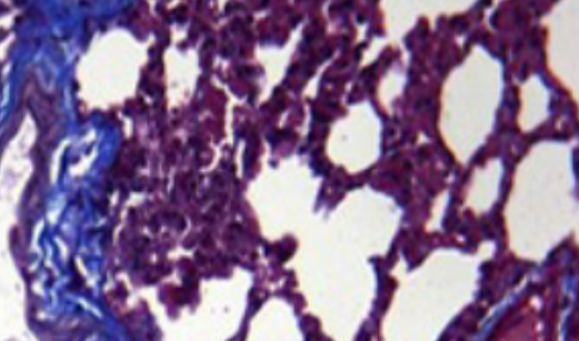 Deletion of sphingosine kinase 2 attenuates cigarette smoke-mediated chronic obstructive pulmonary disease-like symptoms by reducing lung inflammation