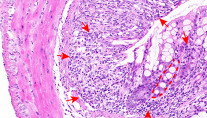 Promotive role of IRF7 in ferroptosis of colonic epithelial cells in ulcerative colitis by the miR-375-3p/SLC11A2