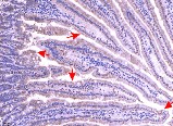 Promotive role of IRF7 in ferroptosis of colonic epithelial cells in ulcerative colitis by the miR-375-3p/SLC11A2