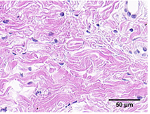 Possible mechanism of static progressive stretching combined with extracorporeal shock wave therapy in reducing knee joint contracture in rats based on MAPK/ERK pathway