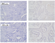 C5aR1 shapes a non-inflammatory tumor microenvironment and mediates immune evasion in gastric cancer