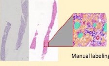 Artificial intelligence in renal pathology: Current status and future