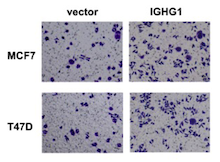 IGHG1 promotes malignant progression in breast cancer cells through the regulation of AKT and VEGF signaling