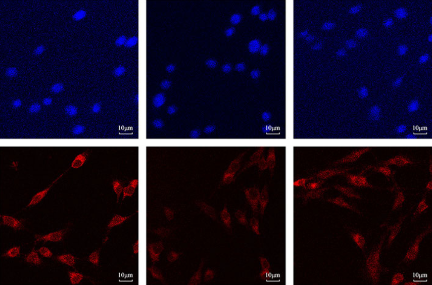 Sivelestat sodium attenuates acute lung injury by inhibiting JNK/NF-κB and activating Nrf2/HO-1 signaling pathways