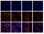 Sivelestat sodium attenuates acute lung injury by inhibiting JNK/NF-κB and activating Nrf2/HO-1 signaling pathways