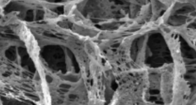 Intervertebral disk regeneration in a rat model by allopurinol–loaded chitosan/alginate hydrogel