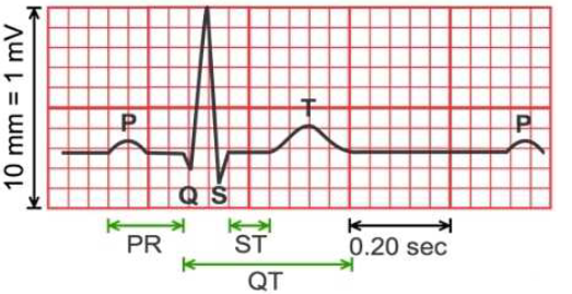 Electrodermal activity and heart rate variability for detection of peripheral abnormalities in type 2 diabetes: A review