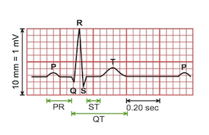 Electrodermal activity and heart rate variability for detection of peripheral abnormalities in type 2 diabetes: A review