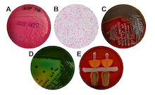 Etiology and clinical features of non-O1/non-O139 Vibrio cholerae infection in an inland city in China