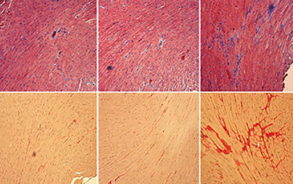 Exogenous spermidine alleviates diabetic cardiomyopathy via suppressing reactive oxygen species, endoplasmic reticulum stress, and Pannexin-1-mediated ferroptosis