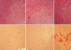 Exogenous spermidine alleviates diabetic cardiomyopathy via suppressing reactive oxygen species, endoplasmic reticulum stress, and Pannexin-1-mediated ferroptosis