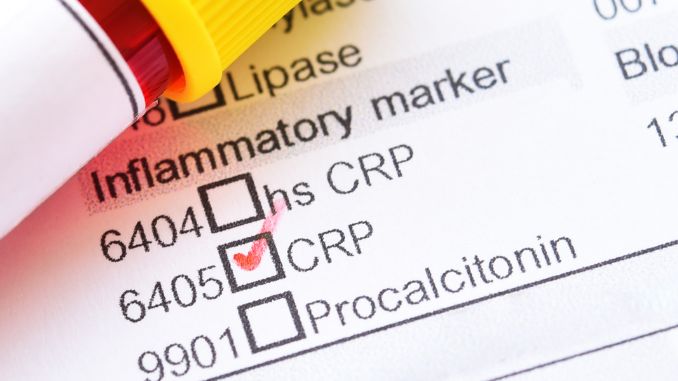 Identification of new biomarkers and immune infiltration characteristics of sepsis in very low birth weight infants