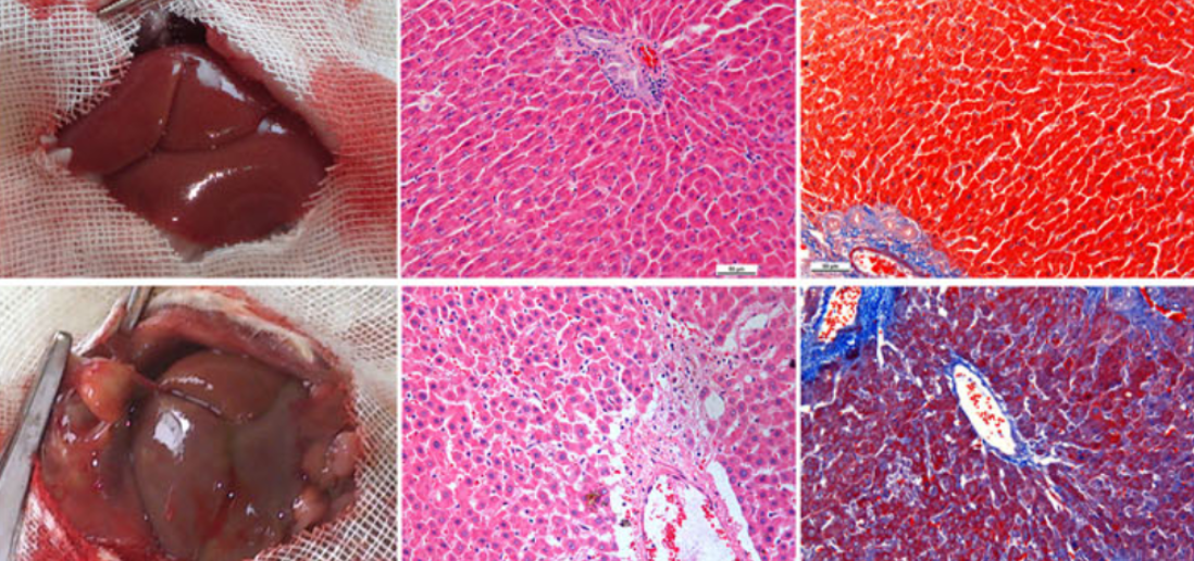 SKIL/SnoN attenuates TGF-β1/SMAD signaling-dependent collagen synthesis in hepatic fibrosis 