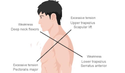 Exploring the latest advancements in physical therapy techniques for treating cervical spondylosis patients: A narrative review