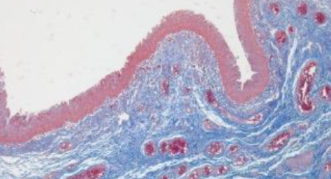 Small intestinal submucosa promotes angiogenesis via the Hippo pathway to improve vaginal repair