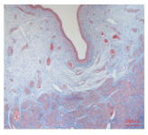 Small intestinal submucosa promotes angiogenesis via the Hippo pathway to improve vaginal repair