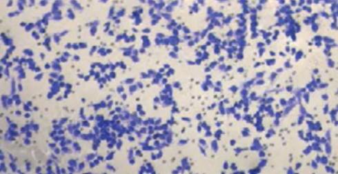 A novel autophagy-related subtypes to distinguish immune phenotypes and predict immunotherapy response in head and neck squamous cell carcinoma