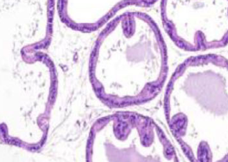 Effects of the CB1 receptor antagonists AM6545 and AM4113 on metabolic syndrome-induced prostatic hyperplasia in rats