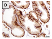 Effects of the CB1 receptor antagonists AM6545 and AM4113 on metabolic syndrome-induced prostatic hyperplasia in rats