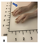 Alcoholic extracts of Teucrium polium exhibit remarkable anti-inflammatory activity: In vivo study