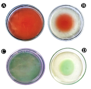 Biosurfactant derived from probiotic Lactobacillus acidophilus exhibits broad-spectrum antibiofilm activity and inhibits the quorum sensing-regulated virulence