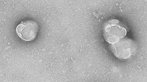 Comprehensive exosomal microRNA profile and construction of competing endogenous RNA network in autism spectrum disorder: A pilot study