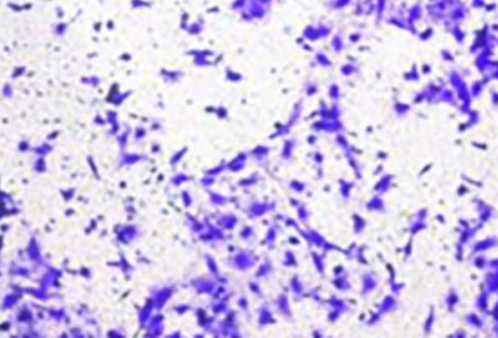 Parathyroid hormone-related protein as a potential prostate cancer biomarker: Promoting prostate cancer progression through upregulation of c-Met expression