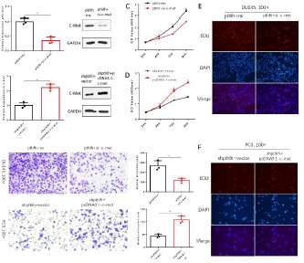Parathyroid hormone-related protein as a potential prostate cancer biomarker: Promoting prostate cancer progression through upregulation of c-Met expression