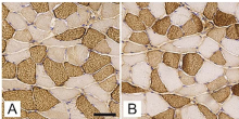 Skeletal muscle myosin heavy chain expression and 3D capillary network changes in streptozotocin-induced diabetic female mice