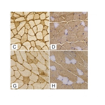 Skeletal muscle myosin heavy chain expression and 3D capillary network changes in streptozotocin-induced diabetic female mice