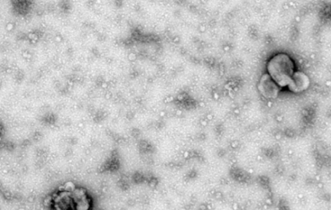 Exosome miR-4738-3p-mediated regulation of COL1A2 through the NF-κB and inflammation signaling pathway alleviates osteoarthritis low-grade inflammation symptoms
