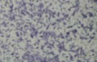 Cell division cycle 42 effector protein 4 inhibits prostate cancer progression by suppressing ERK signaling pathway