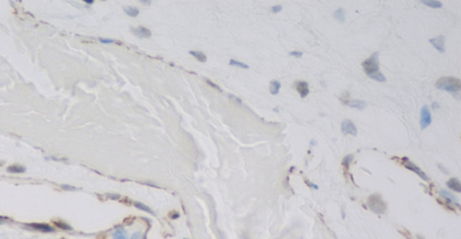 Expression of CD31, CD34, and smooth muscle actin (SMA) in endothelial cells of dental pulp vessels