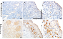 Hypomethylation of the ENPP3 promoter region contributes to the occurrence and development of ovarian endometriosis via the AKT/mTOR/4EBP1 signaling pathway